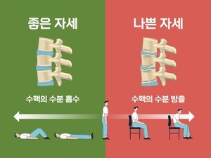 나이 들수록 줄어드는 키? … 척추질환이 원인인 경우 많아